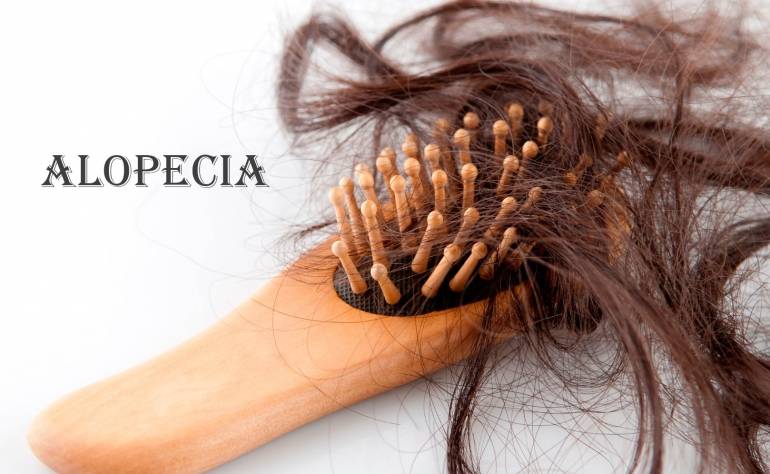 Кому найкраще підходить PP405 для лікування алопеції: вік, стать, генетика